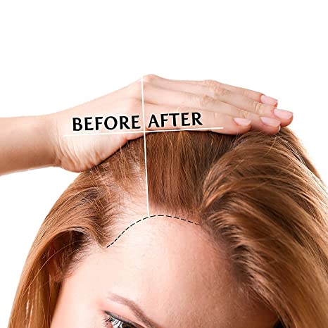 Luv Me Care Hair Growth Oil Hair Growth Serum for Thicker Longer Fuller Healthier Hair | 1.7 oz