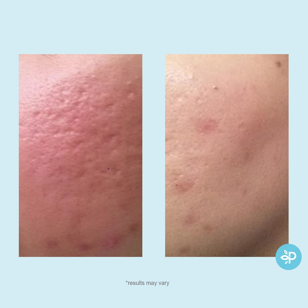 Perfect Image Lactic Gel Peel Tone Strength Level 2, 1 oz / 30 ml