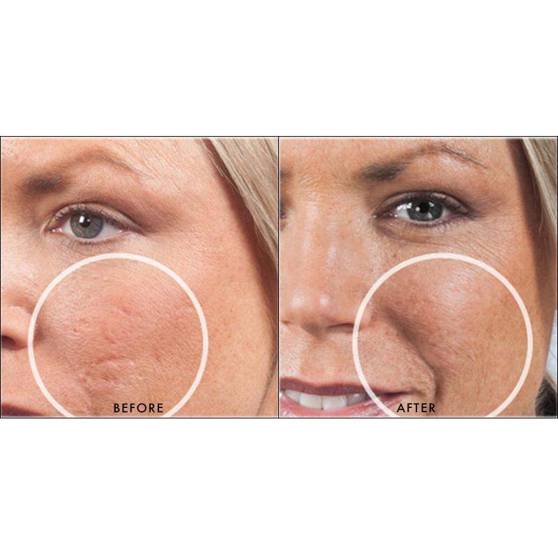 Dermaflage Single Applicator (Golden Fair)