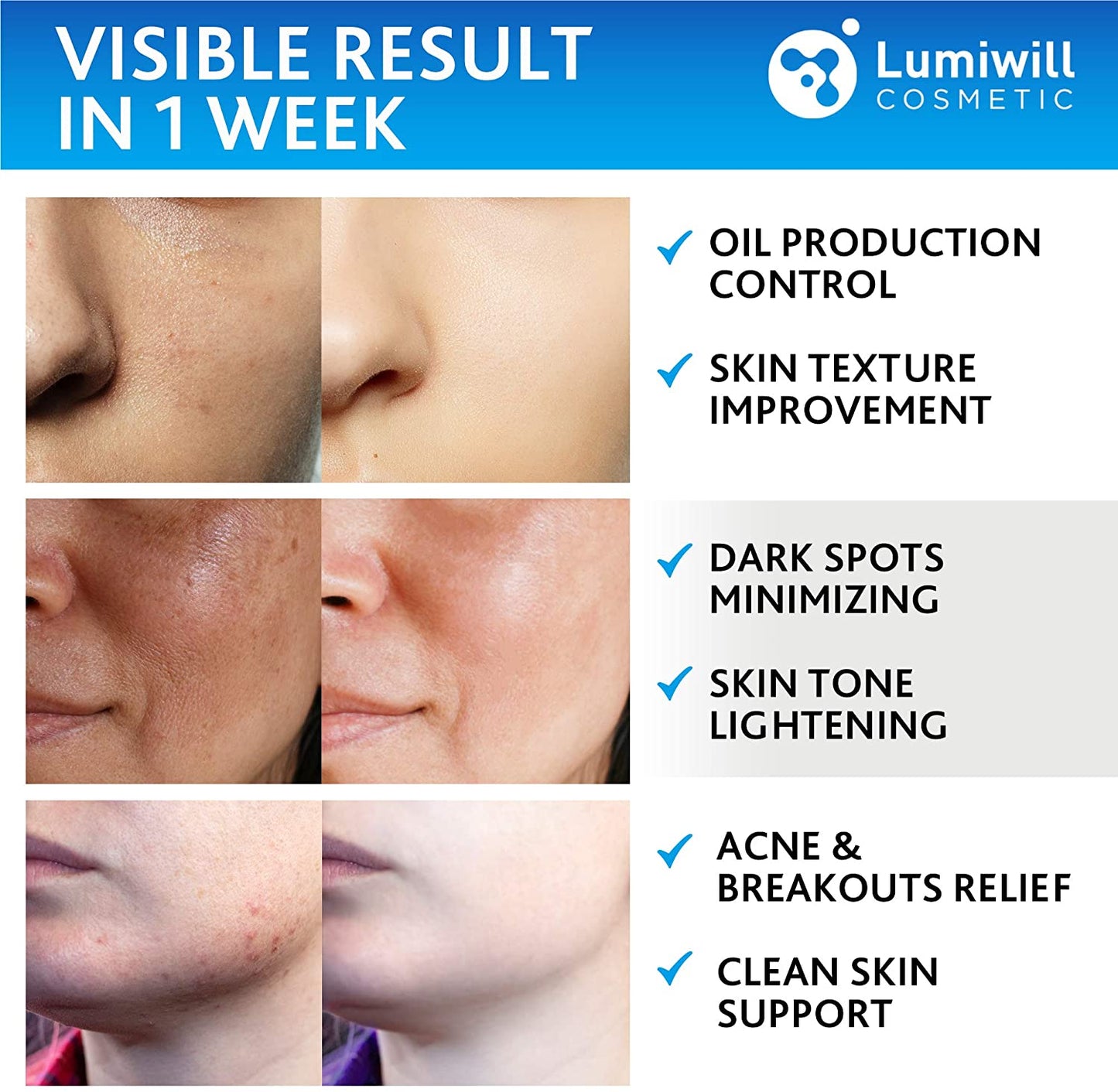 Lumiwill Cosmetic Glycolic Acid Pads 35% Facial Peel Anti-Aging Resurfacing Pads with Vitamins B5, C, E & Menthol, 50 Pads