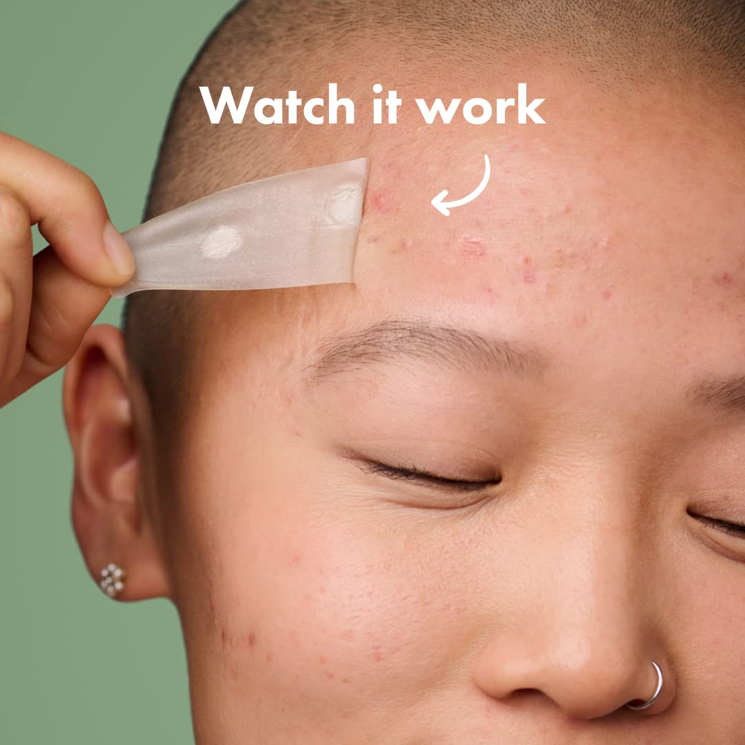 Hero Mighty Patch Surface 10 Patches