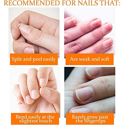 Nail Tek Nail Recovery Kit Restores Damaged Nails 0.5 Fl Oz / 15 ml Per Bottle