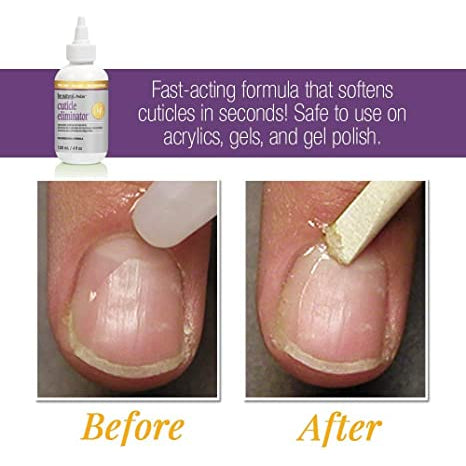 ProLinc Be Natural Cuticle Eliminator Removes Cuticles in Seconds | 4 oz
