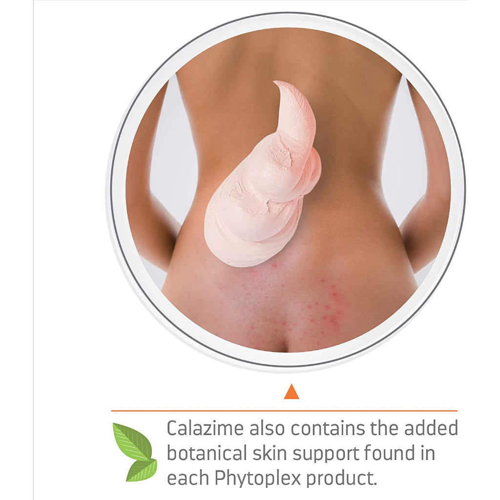 Medline Remedy Specialized skin protectant with Menthol Unscented, 4 oz.