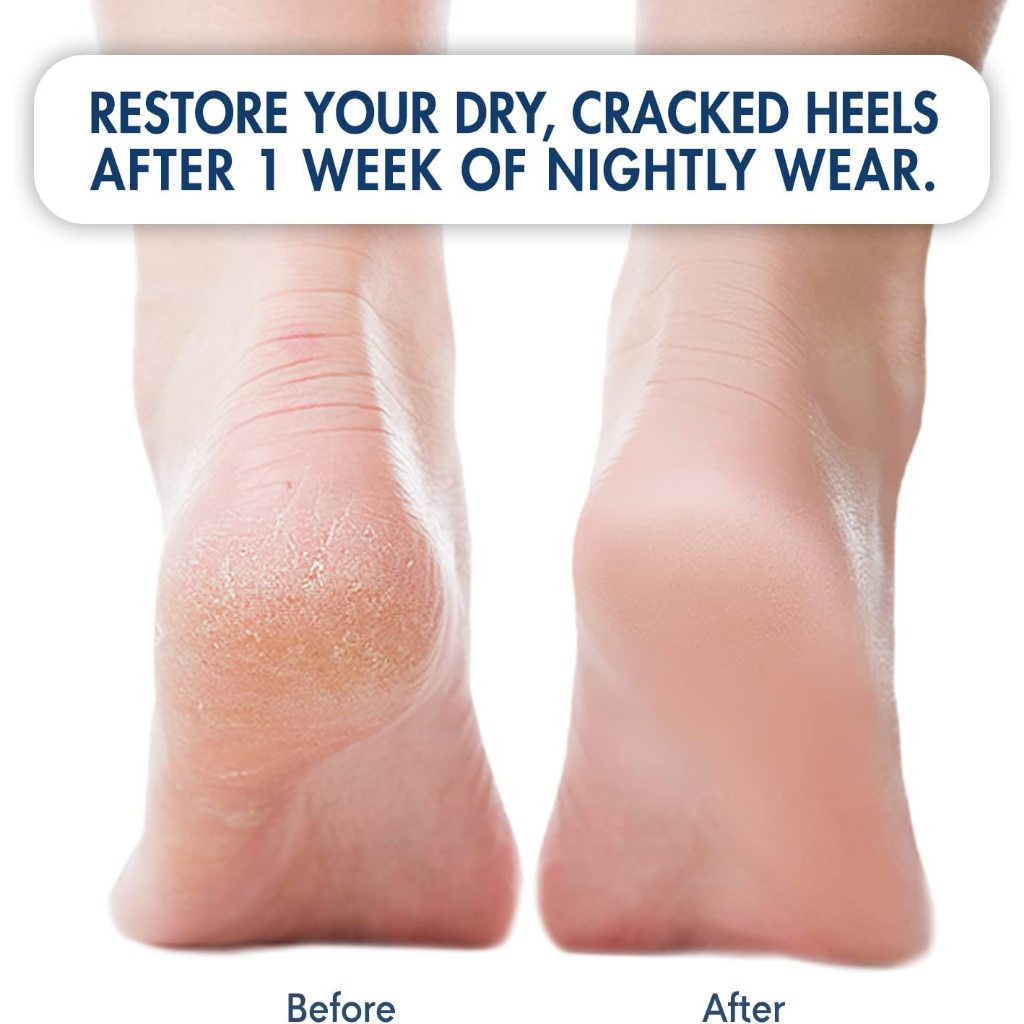 Dr. Frederick's Original Moisturizing Heel Socks Cracked Heel Relief 4 Count